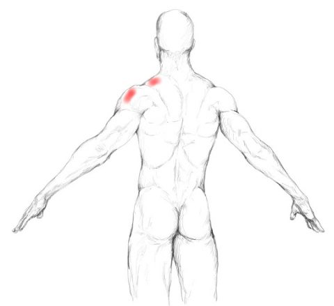 eksplosion eksplodere sovjetisk Biceps brachii muscle pain & trigger points