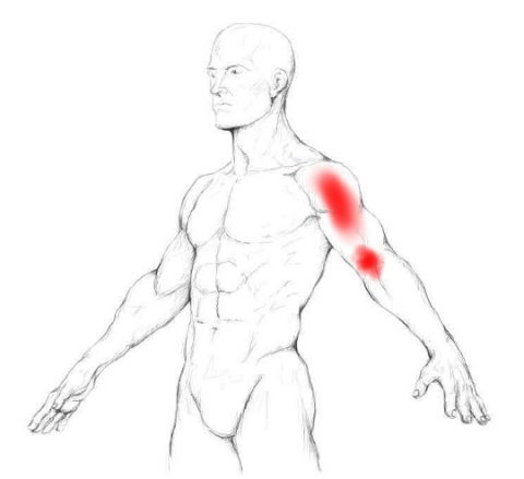 Get Rid Of Pain In The Elbow The Elbow Pit
