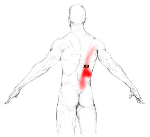 Erector Spinae Muscle Pain Trigger Points