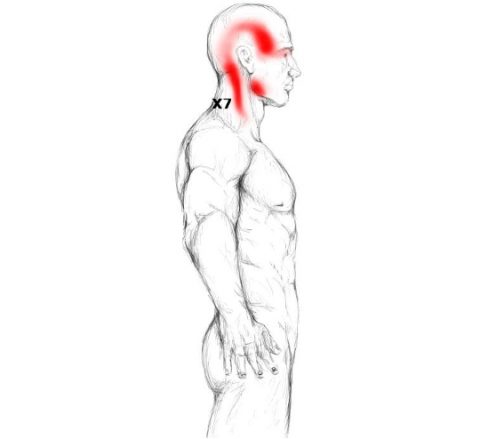 https://www.muscle-joint-pain.com/wp-content/uploads//trapezius-trigger-point-pain-480x439.jpg