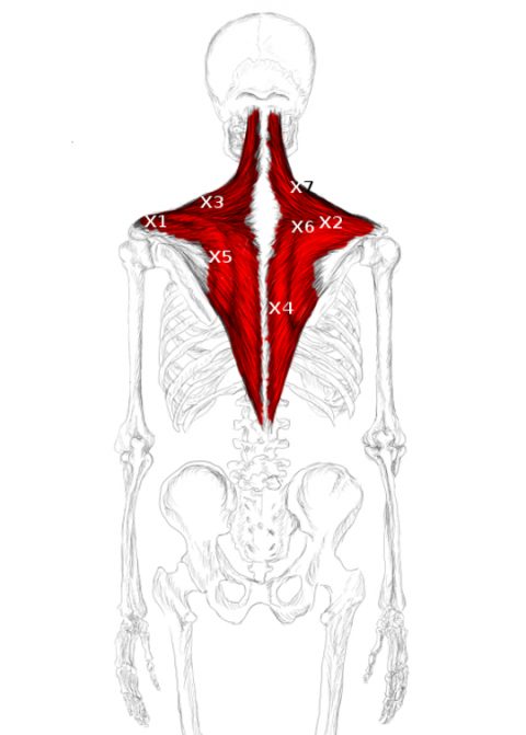 Trapezius muscle pain & trigger points