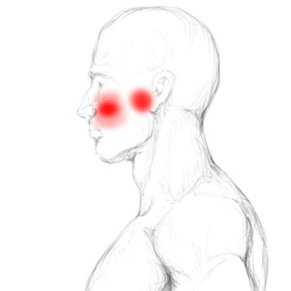 Lateral pterygoid Pain & Trigger Points
