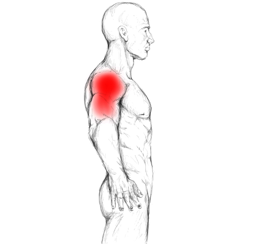 Deltoid muscle pain & trigger points