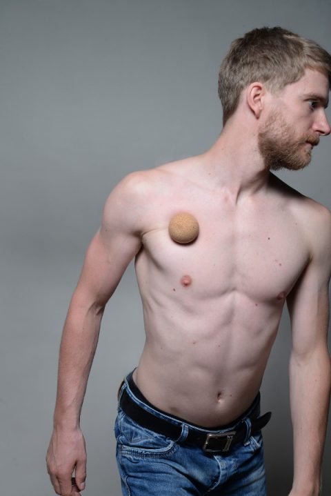 Pectoralis major muscle pain & trigger points