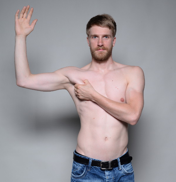 Pectoralis major muscle pain & trigger points