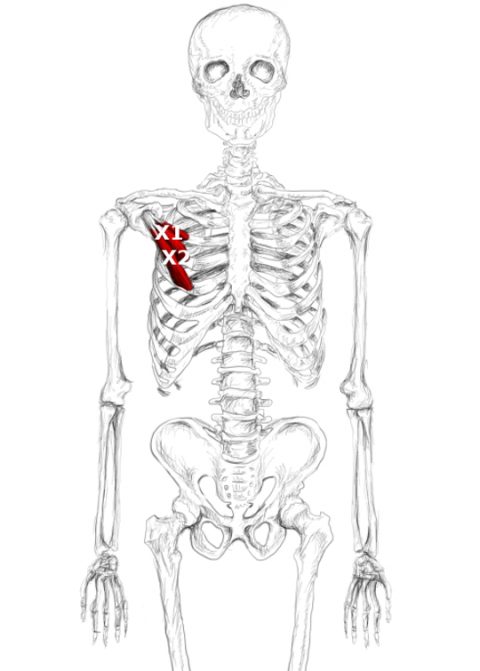 Pectoralis minor pain & trigger points