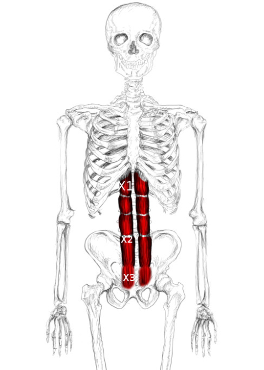 Rectus abdominis pain & trigger points