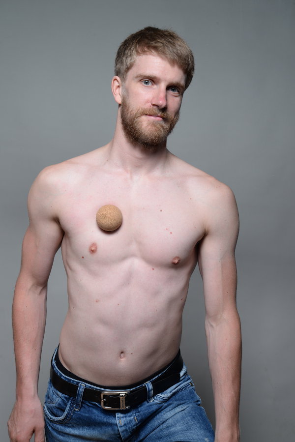 Muscle pain in the upper arm front selftreatment