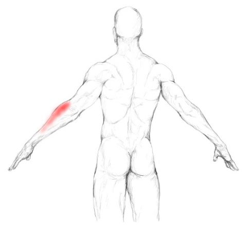 infraspinatus subclavius muscle schmerzen triggerpunkte schulter nacken behandeln