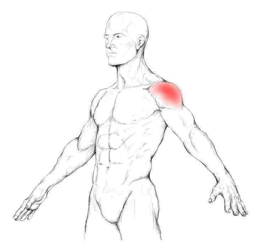 Teres major muscle pain & trigger points